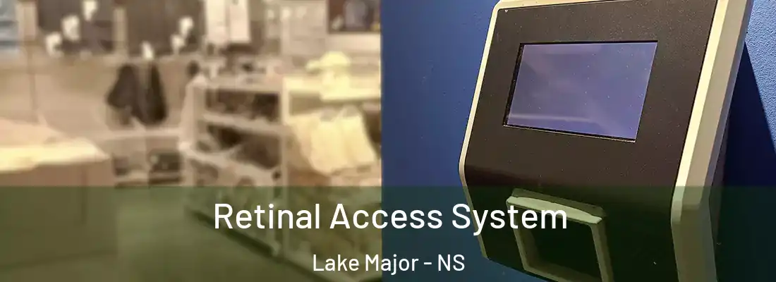 Retinal Access System Lake Major - NS
