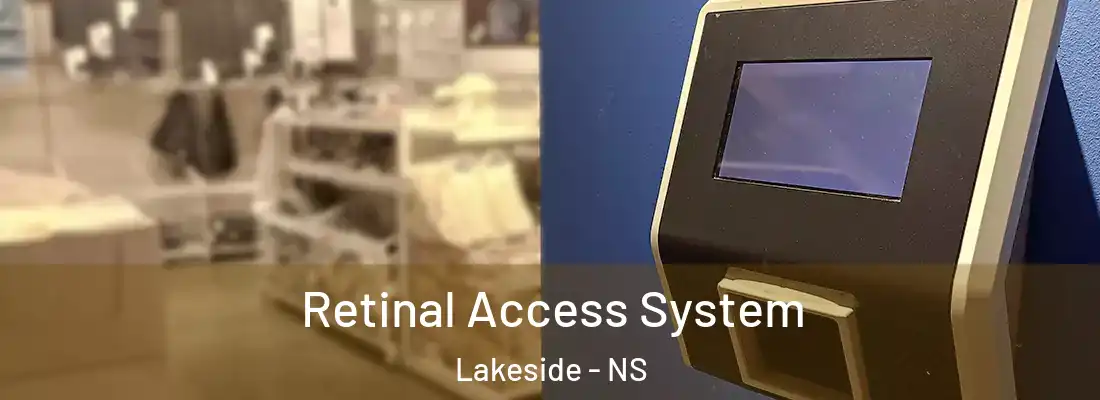 Retinal Access System Lakeside - NS