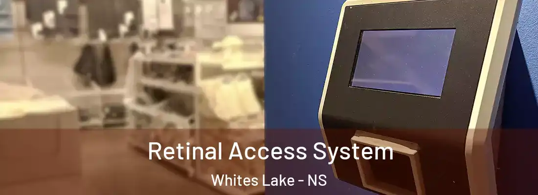 Retinal Access System Whites Lake - NS