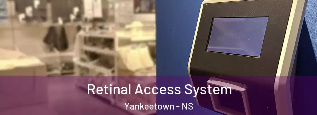 Retinal Access System Yankeetown - NS